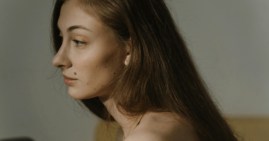 how to get rid of beauty marks on face