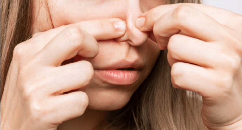 how to get rid of whiteheads overnight.