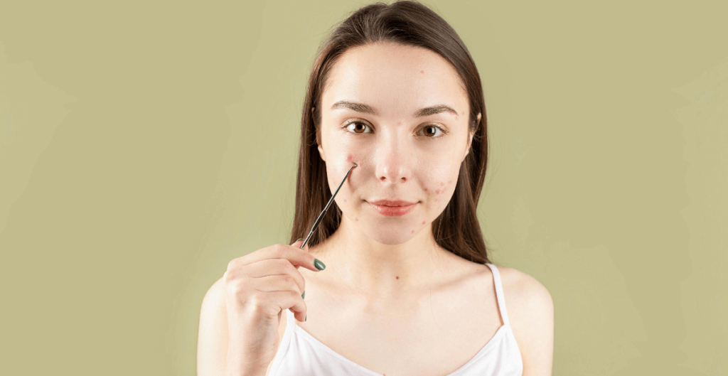 how to get rid of whiteheads overnight.