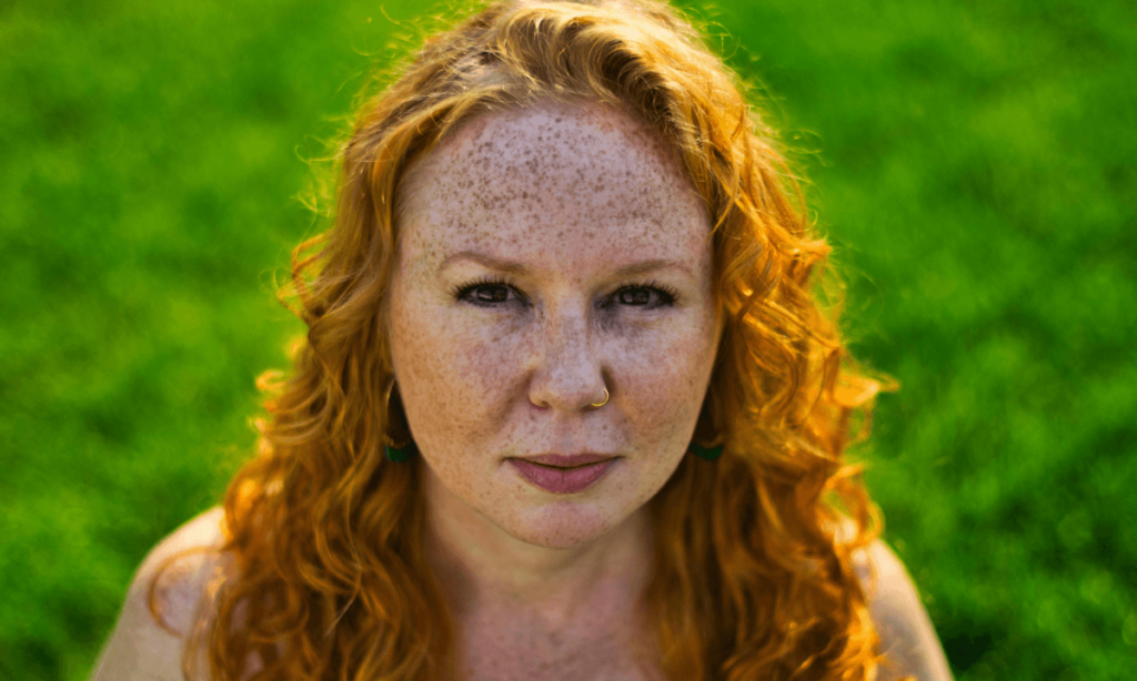 how to get rid of beauty marks on face