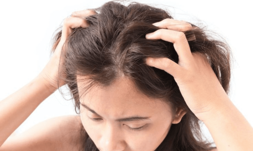 dry scalp vs dandruff